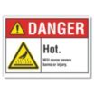 Danger: Hot. Will Cause Severe Burns Or Injury. Signs